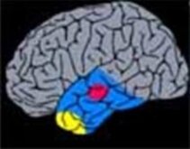 1. Temporal Lobectomy/Topectomy