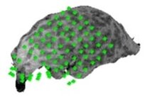 The image of electrode grid position made by means of curvilinear reformatting 