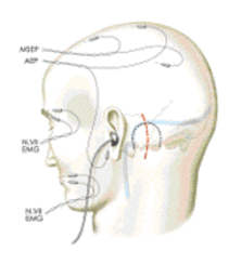 Electrophysiological monitoring